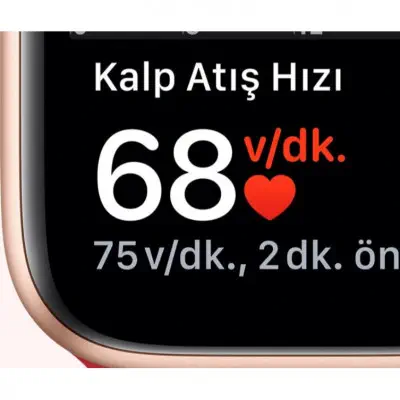 Apple Watch SE Altın Alüminyum Kasa ve Yıldız Işığı Spor Kordon