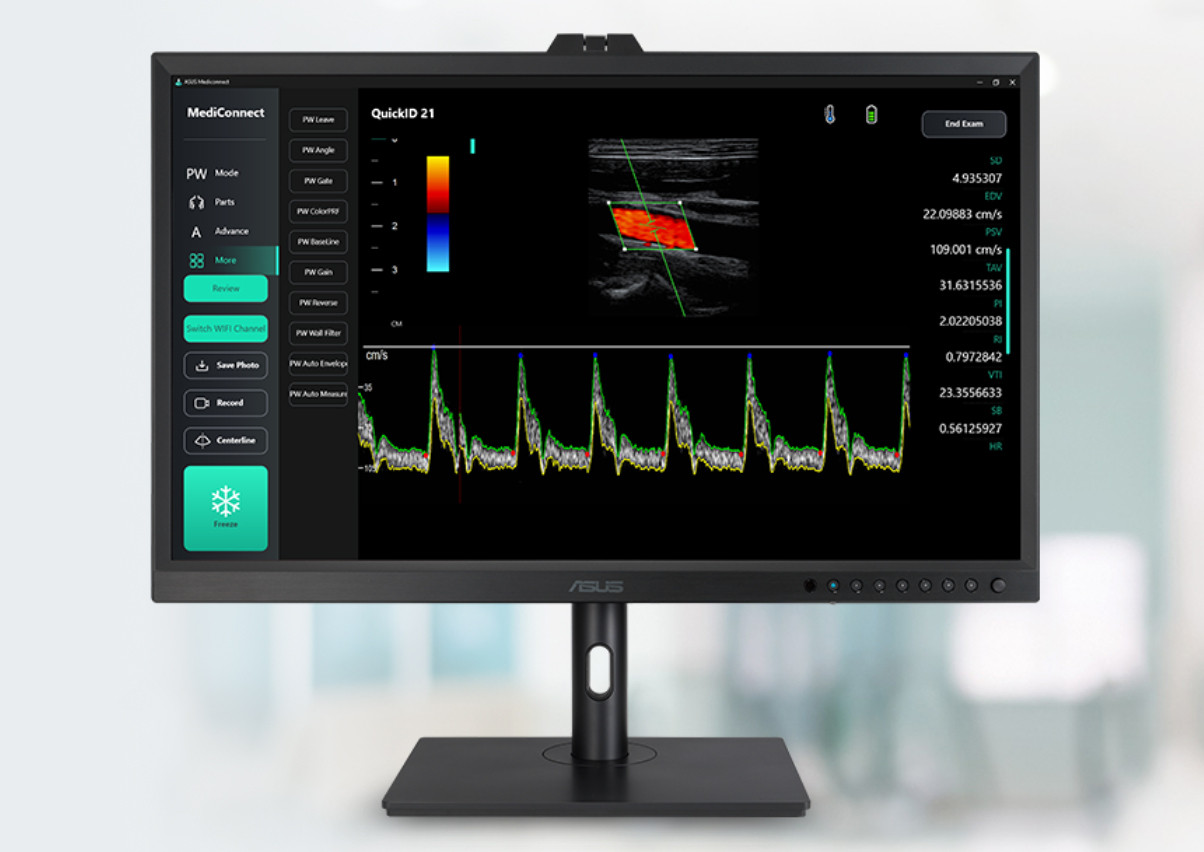 ASUS HA3281A 32″ 0.1ms 60Hz HealthCare 4K Ultra HD IPS  Monitör