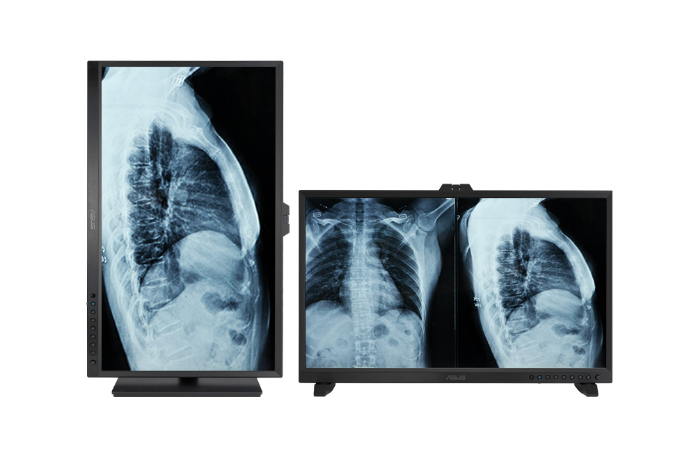 ASUS HA3281A 32″ 0.1ms 60Hz HealthCare 4K Ultra HD IPS  Monitör
