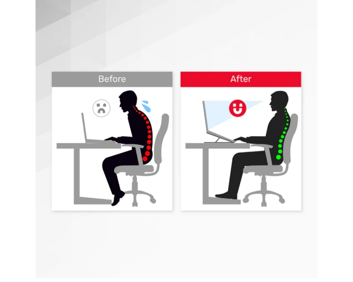 Unitek Mekanik Katlanabilir Dizüstü Bilgisayar Standı (OT155SL)